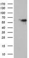 Monoamine Oxidase A antibody, TA504265, Origene, Western Blot image 