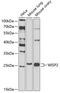 Cellular Communication Network Factor 5 antibody, GTX33585, GeneTex, Western Blot image 
