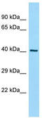 Isocitrate Dehydrogenase (NAD(+)) 3 Beta antibody, TA331329, Origene, Western Blot image 