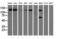 L1 Cell Adhesion Molecule antibody, GTX84232, GeneTex, Western Blot image 