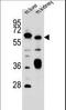 Proton myo-inositol cotransporter antibody, LS-B9621, Lifespan Biosciences, Western Blot image 