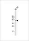 Casein Kinase 1 Gamma 2 antibody, 62-886, ProSci, Western Blot image 