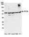RNA 2',3'-Cyclic Phosphate And 5'-OH Ligase antibody, A305-077A, Bethyl Labs, Western Blot image 