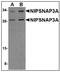 Nipsnap Homolog 3A antibody, AP23003PU-N, Origene, Western Blot image 