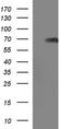CTD Small Phosphatase 2 antibody, CF507255, Origene, Western Blot image 