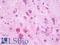 Centrosomal Protein 135 antibody, LS-B9715, Lifespan Biosciences, Immunohistochemistry paraffin image 