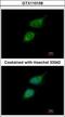 TRIO And F-Actin Binding Protein antibody, GTX110158, GeneTex, Immunocytochemistry image 