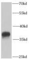 Protein Phosphatase 2 Catalytic Subunit Alpha antibody, FNab06712, FineTest, Western Blot image 