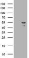 Parvin Beta antibody, TA505714AM, Origene, Western Blot image 