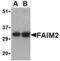 Fas Apoptotic Inhibitory Molecule 2 antibody, MBS150668, MyBioSource, Western Blot image 