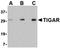 TP53 Induced Glycolysis Regulatory Phosphatase antibody, orb74805, Biorbyt, Western Blot image 