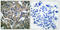 Phospholipase C-gamma-1 antibody, A00677Y783-1, Boster Biological Technology, Immunohistochemistry paraffin image 