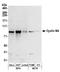 Cyclin And CBS Domain Divalent Metal Cation Transport Mediator 4 antibody, A304-469A, Bethyl Labs, Western Blot image 