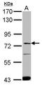 Solute Carrier Family 27 Member 4 antibody, GTX100842, GeneTex, Western Blot image 