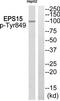 Epidermal Growth Factor Receptor Pathway Substrate 15 antibody, TA313129, Origene, Western Blot image 