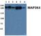 Mitogen-Activated Protein Kinase Kinase Kinase 4 antibody, PA5-75856, Invitrogen Antibodies, Western Blot image 
