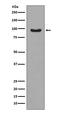 Forkhead Box O3 antibody, P00252, Boster Biological Technology, Western Blot image 