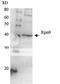 Proteasome 26S Subunit, Non-ATPase 13 antibody, 62-207, BioAcademia Inc, Western Blot image 