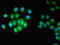 HUS1 Checkpoint Clamp Component antibody, orb239151, Biorbyt, Immunocytochemistry image 