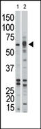 Activin A Receptor Type 1B antibody, AP14598PU-N, Origene, Western Blot image 