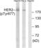 ERBB2 antibody, abx012543, Abbexa, Western Blot image 