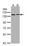 Kinesin-like protein KIF11 antibody, PA5-28933, Invitrogen Antibodies, Western Blot image 