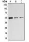 BCL2 Associated Athanogene 5 antibody, LS-C353180, Lifespan Biosciences, Western Blot image 