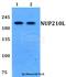 Nucleoporin 210 Like antibody, A16864, Boster Biological Technology, Western Blot image 