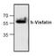 PBEF antibody, TA319132, Origene, Western Blot image 