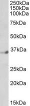 Zinc finger protein neuro-d4 antibody, TA311193, Origene, Western Blot image 