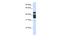 Homogentisate 1,2-Dioxygenase antibody, A01909, Boster Biological Technology, Western Blot image 