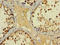B melanoma antigen 3 antibody, A65774-100, Epigentek, Immunohistochemistry paraffin image 