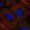 DNA Topoisomerase III Beta antibody, HPA069678, Atlas Antibodies, Immunofluorescence image 