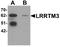 Leucine Rich Repeat Transmembrane Neuronal 3 antibody, A11290, Boster Biological Technology, Western Blot image 