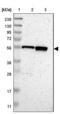 Chromosome 17 Open Reading Frame 80 antibody, NBP1-83637, Novus Biologicals, Western Blot image 
