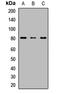 UDP Glucuronosyltransferase Family 1 Member A6 antibody, orb411646, Biorbyt, Western Blot image 