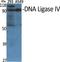 DNA Ligase 4 antibody, A01685, Boster Biological Technology, Western Blot image 