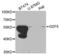 Growth Differentiation Factor 5 antibody, LS-C348952, Lifespan Biosciences, Western Blot image 