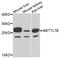 Methyltransferase-like protein 7B antibody, STJ29280, St John