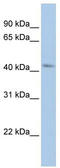 BarH Like Homeobox 2 antibody, TA342461, Origene, Western Blot image 