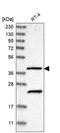 Solute Carrier Family 43 Member 2 antibody, HPA021564, Atlas Antibodies, Western Blot image 