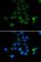 Tyrosine Aminotransferase antibody, LS-C334930, Lifespan Biosciences, Immunofluorescence image 