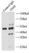 3-hydroxyacyl-CoA dehydrogenase type-2 antibody, FNab02823, FineTest, Immunoprecipitation image 