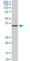 Serine And Arginine Rich Splicing Factor 9 antibody, H00008683-M01, Novus Biologicals, Western Blot image 