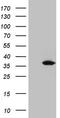 Uridine-Cytidine Kinase 2 antibody, CF809419, Origene, Western Blot image 