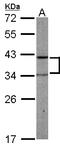 Phosphoribosyl Pyrophosphate Synthetase Associated Protein 2 antibody, LS-C185892, Lifespan Biosciences, Western Blot image 