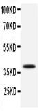 Solute Carrier Family 10 Member 1 antibody, PA1532, Boster Biological Technology, Western Blot image 