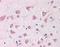 Fanconi anemia group G protein antibody, orb86607, Biorbyt, Immunohistochemistry paraffin image 