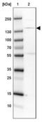 Structural Maintenance Of Chromosomes 3 antibody, NBP1-88715, Novus Biologicals, Western Blot image 