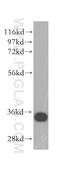 Microtubule Associated Protein RP/EB Family Member 1 antibody, 17717-1-AP, Proteintech Group, Western Blot image 